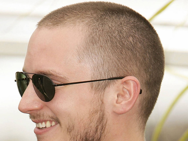 bald head regrow hair